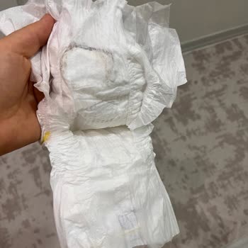 Molfix Bebek Bezinde Kirli Görünüm Üretim Hatası Şüphesi