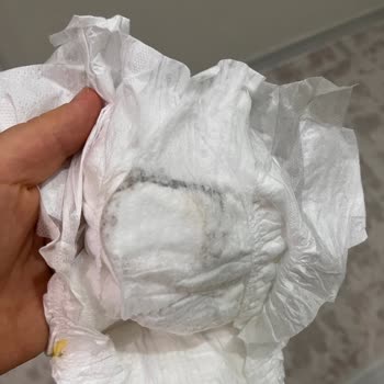 Molfix Bebek Bezinde Kirli Görünüm Üretim Hatası Şüphesi