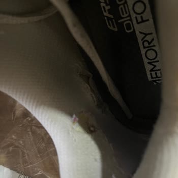 Skechers Ayakkabısının Kalitesizliği Ve Mağazanın Haksız Kullanıcı Hatası İddiası