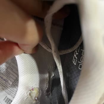 Skechers Ayakkabısının Kalitesizliği Ve Mağazanın Haksız Kullanıcı Hatası İddiası