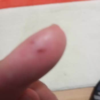 Ürün Vaadi Yerine Getirilmedi, Cilde Zarar Verdi, Tam İade Talebi
