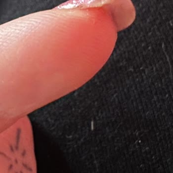Bonita Nail'de Jel Güçlendirme Sonrası Tırnak Açılması Ve Ücret Talebi