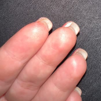 Bonita Nail'de Jel Güçlendirme Sonrası Tırnak Açılması Ve Ücret Talebi
