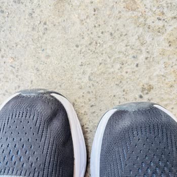 Adidas Ayakkabım 1 Saatte Çöktü, Garanti Reddi Kabul Edilemez