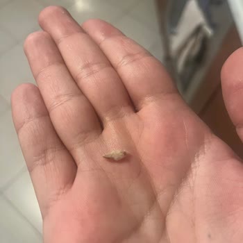 Burger King Tavuk Burgerinde Tırnak Bulunması Gıda Güvenliğini Tehdit Ediyor