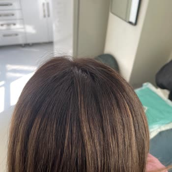Uzun Bekleme, Yanlış Renk Ve Hijyen Eksikliğiyle 10.500 TL’lik Kuaför Kabusu
