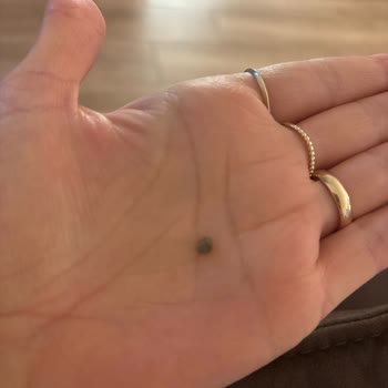 Yayla Yeşil Mercimekte Taş Kontaminasyonu Diş Ve Güvenlik Riskine Dönüştü