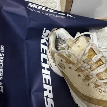 Kısa Sürede Deforme Olmuş Skechers Ayakkabısının Garanti Reddi Ve Değişim Talebi