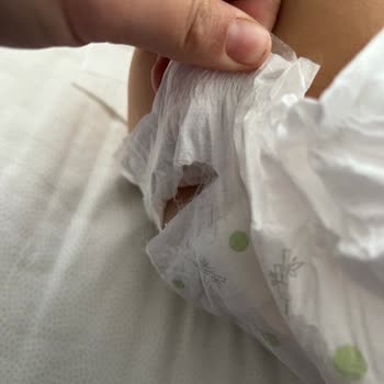 Sleepy Bebek Bezinde Yırtıklar Ve Şiddetli Sızıntı, Telafi Talebi