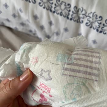 Molfix Bebek Bezinde Kıl Bulunması Hijyen Ve Güven Sorunu