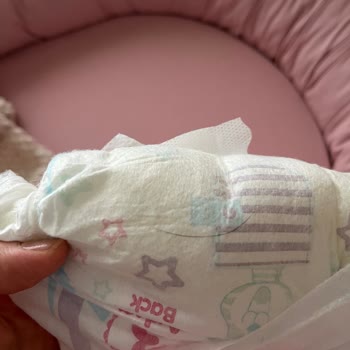Molfix Bebek Bezinde Kıl Bulunması Hijyen Ve Güven Sorunu