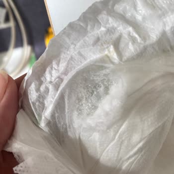Defolu Bebek Bezi Ve Şirketin Cevap Vermemesi