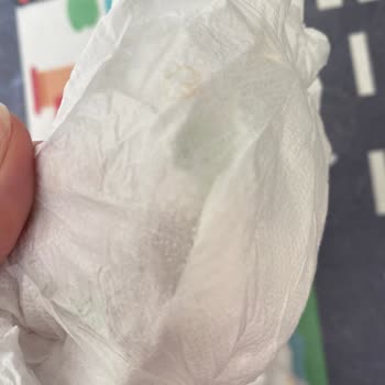 Defolu Bebek Bezi Ve Şirketin Cevap Vermemesi