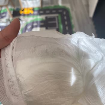 Defolu Bebek Bezi Ve Şirketin Cevap Vermemesi