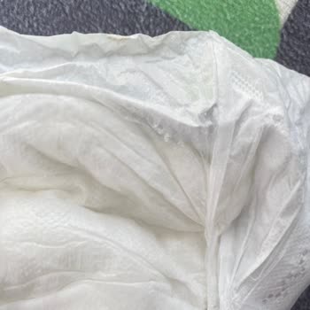 Defolu Bebek Bezi Ve Şirketin Cevap Vermemesi