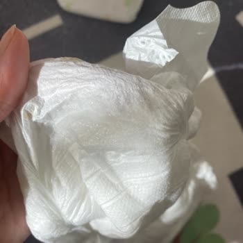 Defolu Bebek Bezi Ve Şirketin Cevap Vermemesi