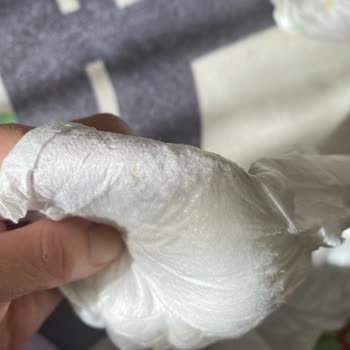 Defolu Bebek Bezi Ve Şirketin Cevap Vermemesi