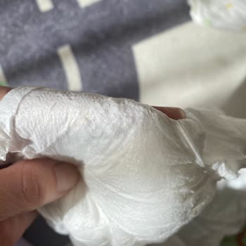 Defolu Bebek Bezi Ve Şirketin Cevap Vermemesi
