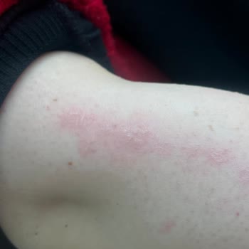 Tülay Mutlu Güzellik Salonu Hem Fiziksel Hem De Psikolojik Olarak Olumsuz Etkilendim