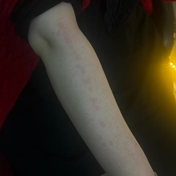 Tülay Mutlu Güzellik Salonu Hem Fiziksel Hem De Psikolojik Olarak Olumsuz Etkilendim