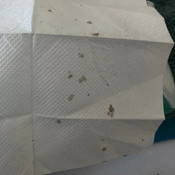 Sofia Peçetede Hijyen Sorunu