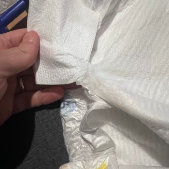 Molfix 6 Numaralı Bebek Bezinde Sızdırma, Pişik Ve Kalite Problemleri