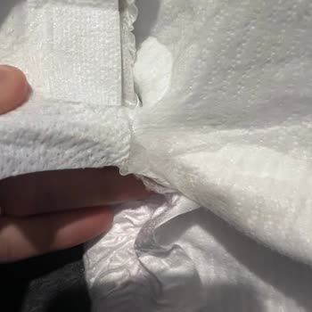 Molfix 6 Numaralı Bebek Bezinde Sızdırma, Pişik Ve Kalite Problemleri
