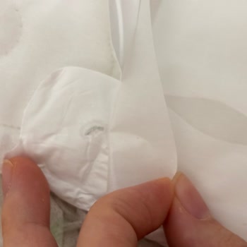 Molped Gece Pedi İçinde Yabancı Madde Hijyen Endişesi Ve İade Talebi
