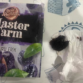 Çekirdeksiz Olması Gereken Kuru Erikte Büyük Çekirdek Ve Diş Kırığı Riski