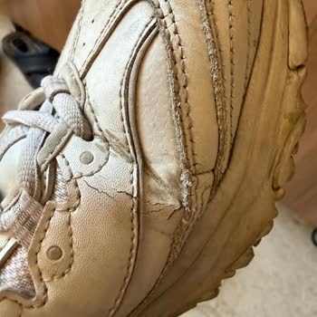 Skechers Kadın Ayakkabısında 6 Ayda Çatlak, Yırtık Ve Yara Sorunu: İade Talebi