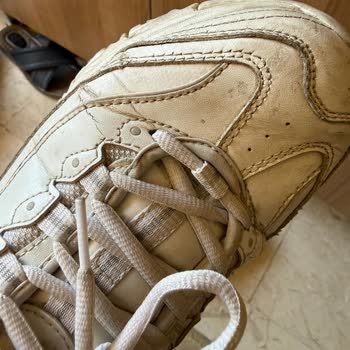 Skechers Kadın Ayakkabısında 6 Ayda Çatlak, Yırtık Ve Yara Sorunu: İade Talebi