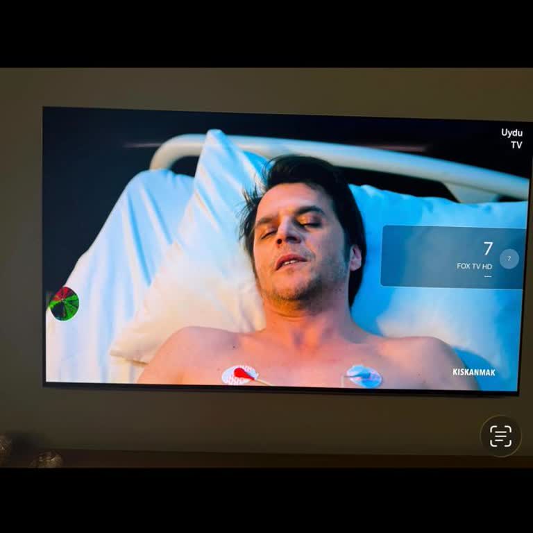 Samsung OLED TV'de 10 Cm Renklenme Sonrası 102.500 TL Panel Değişimi Teklifi
