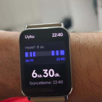 Ekran Çizikleri Nedeniyle Sensör Arızası Garanti Dışı Bırakıldı