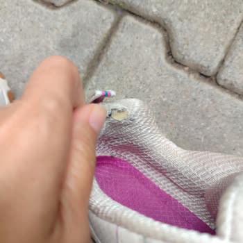 Ayıplı Skechers Ayakkabısı Ve Mağazaya Geri Dönüş İmkânsızlığı