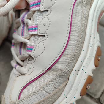 Ayıplı Skechers Ayakkabısı Ve Mağazaya Geri Dönüş İmkânsızlığı