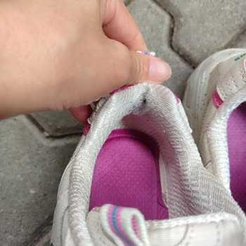 Ayıplı Skechers Ayakkabısı Ve Mağazaya Geri Dönüş İmkânsızlığı