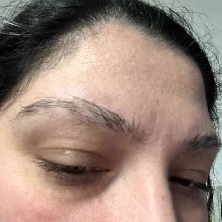 Elseve Glycolic Gloss Kullanımının Saç Dökülmesi, Kaş Dökülmesi Ve Kaşıntıya Yol Açması