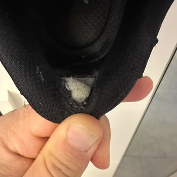 Skechers Ayakkabısının Tabanı 20 Gün İçinde Açıldı, Şikayet Müşteri Kaynaklı Olarak Reddedildi