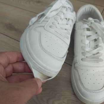 Deichmann Ayakkabım Açıldı, Mağaza Kullanıcı Hatası Dedi Ve İade Reddetti