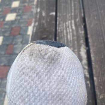 Garanti Altındaki Adidas Ayakkabım Kısa Sürede Yırtıldı, Değişim Reddedildi