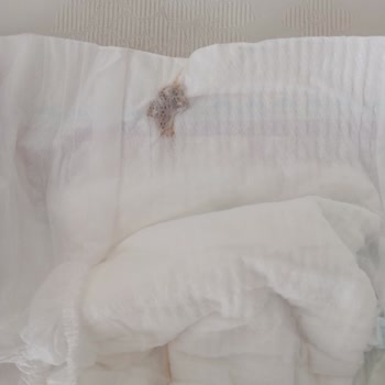 Molfix Bebek Bezinde Yabancı Cisim Tespiti