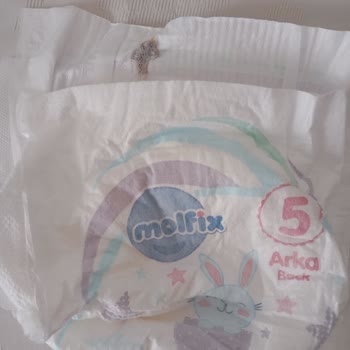 Molfix Bebek Bezinde Yabancı Cisim Tespiti