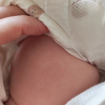 Качество подгузников Huggies Elite Soft Не соответсвует Заявленному, раздражение кожи и сыпь