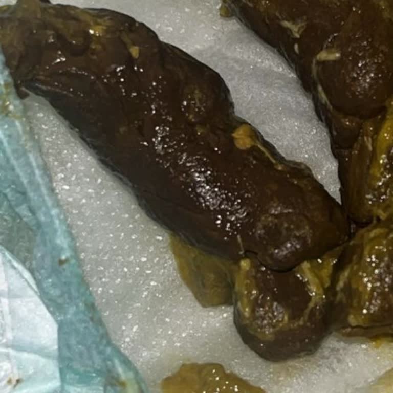 Stok Sorunu Nedeniyle Değişen Mama Bebekte Şiddetli Kabızlığa Yol Açtı