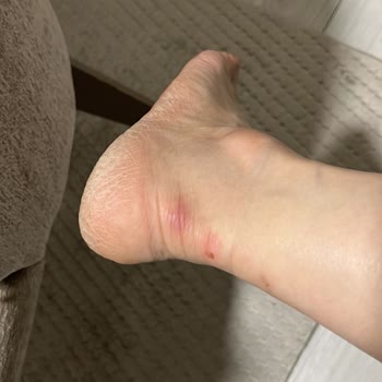 New Balance Mağazasının Bir Aylık Değişim Sözünü İhlali Ve Ürün İadesi Reddi
