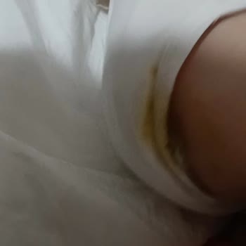 Prima Premium Care Bebek Bezlerinde Sürekli Sızdırma Ve Mağduriyetim