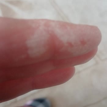DHL Kargo Poşetindeki Zehirli Madde Hamile Olmamı Tehlikeye Atıyor
