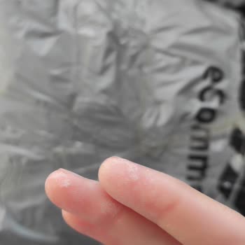DHL Kargo Poşetindeki Zehirli Madde Hamile Olmamı Tehlikeye Atıyor