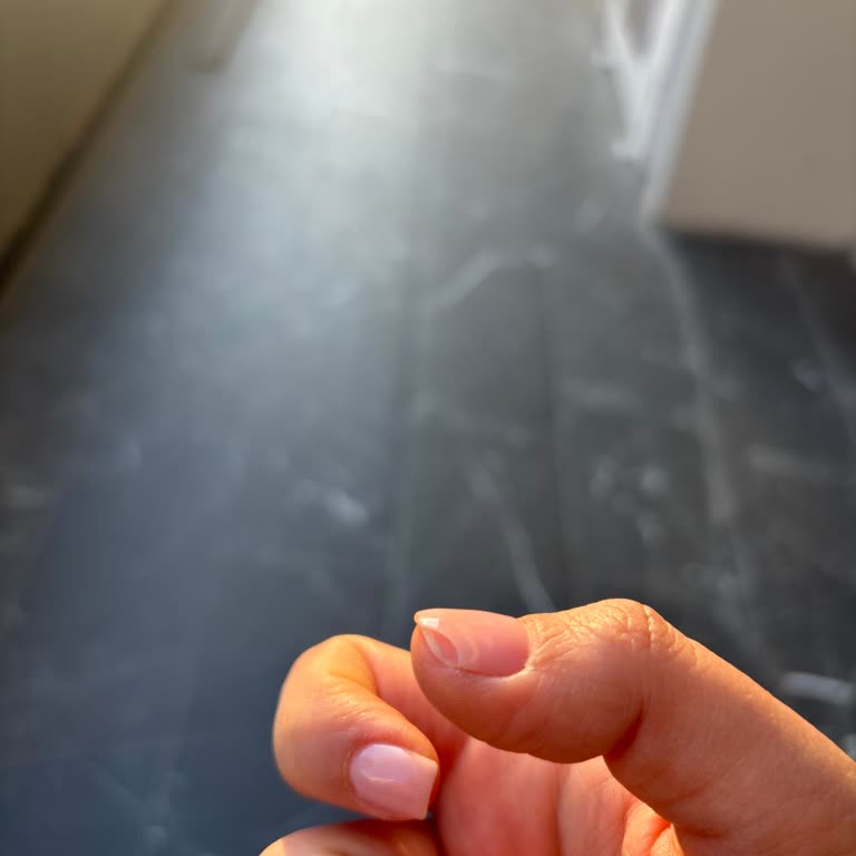 Kalıcı Tırnak İşlemi Kırıldı, Randevu Saatinde Haksız Red