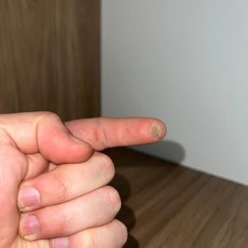 Eğik Baza Ve Kırık, Çekmeceleri Eksik Gardırop Teslimatı